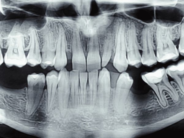After digital diagnosis treatment